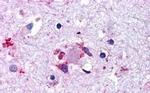 LGR6 Antibody in Immunohistochemistry (Paraffin) (IHC (P))
