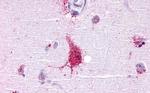 LGR6 Antibody in Immunohistochemistry (Paraffin) (IHC (P))