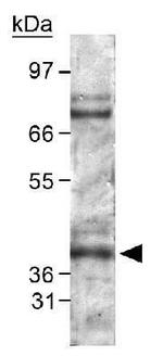 PHD2 Antibody in Western Blot (WB)