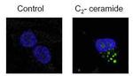 LC3B Antibody in Immunocytochemistry (ICC/IF)