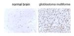 LC3B Antibody in Immunohistochemistry (IHC)