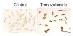 LC3B Antibody in Immunohistochemistry (IHC)