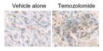 LC3B Antibody in Immunohistochemistry (IHC)