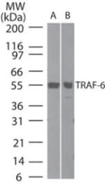 TRAF6 Polyclonal Antibody