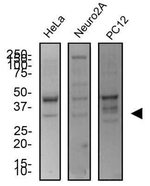 UNG Antibody in Western Blot (WB)
