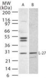 IL-27 p28 Polyclonal Antibody