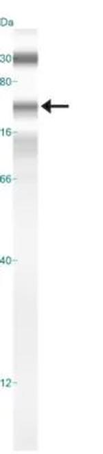 HDAC6 Antibody in Western Blot (WB)