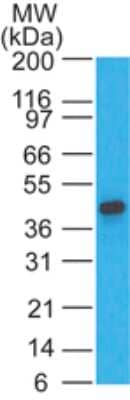 CCR1 Antibody in Western Blot (WB)