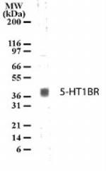 HTR1B Polyclonal Antibody
