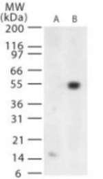 West Nile Virus Envelope Polyclonal Antibody