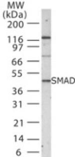 SMAD1/SMAD5/SMAD9 Antibody in Western Blot (WB)