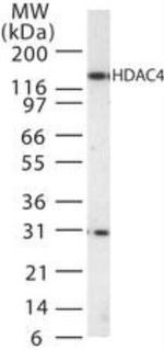 HDAC4 Polyclonal Antibody
