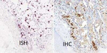 SARS Coronavirus Nucleocapsid Antibody in Immunohistochemistry (Paraffin) (IHC (P))