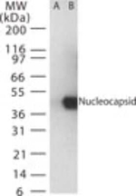 SARS Coronavirus Nucleocapsid Antibody in Western Blot (WB)