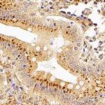 XAF1 Polyclonal Antibody