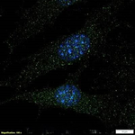 TAK1 Polyclonal Antibody