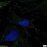 TAK1 Antibody in Immunocytochemistry (ICC/IF)