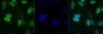 PRMT4 Polyclonal Antibody