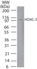 HDAC5 Antibody in Western Blot (WB)