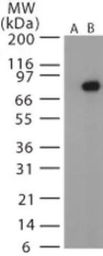 Anthrax Protective Antigen Antibody in Western Blot (WB)