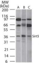 SIRT5 Polyclonal Antibody