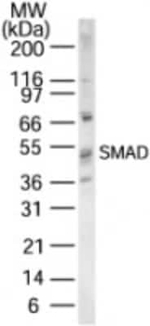 SMAD1/SMAD5/SMAD9 Polyclonal Antibody