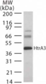 HTRA3 Antibody in Western Blot (WB)
