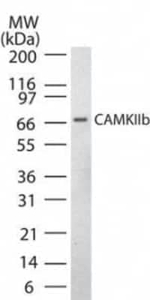 CaMKII beta Antibody in Western Blot (WB)