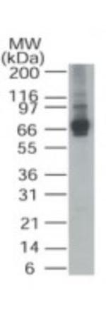 ALAS1 Antibody in Western Blot (WB)