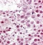 SUMO2/SUMO3 Polyclonal Antibody