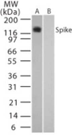 SARS Coronavirus Spike Protein Antibody in Western Blot (WB)