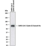 SARS Coronavirus Spike Protein Antibody in Western Blot (WB)