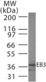 MAPRE3 Polyclonal Antibody