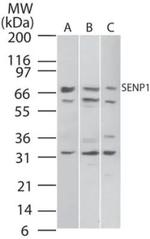SENP1 Polyclonal Antibody