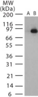 Anthrax Lethal Factor Antibody in Western Blot (WB)