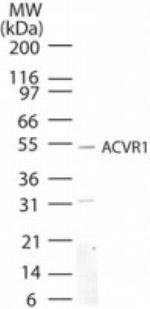 ACVR1 Polyclonal Antibody
