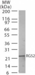 RGS2 Polyclonal Antibody