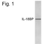 IL18BP Antibody in Western Blot (WB)