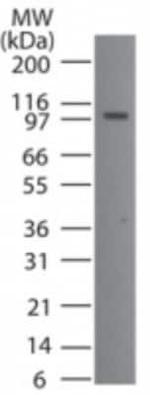 TMEM123 Polyclonal Antibody