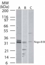 NUS1 Polyclonal Antibody
