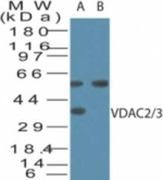 VDAC2/VDAC3 Polyclonal Antibody