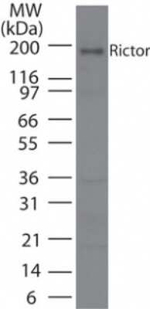 RICTOR Antibody in Western Blot (WB)