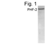 PHF2 Polyclonal Antibody
