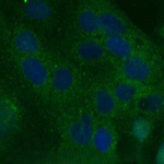 TIM-1 Antibody in Immunocytochemistry (ICC/IF)