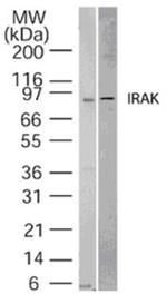 IRAK1 Polyclonal Antibody