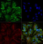 TRAIL-R2 (DR5) Polyclonal Antibody