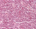 GATAD2A Antibody in Immunohistochemistry (Paraffin) (IHC (P))