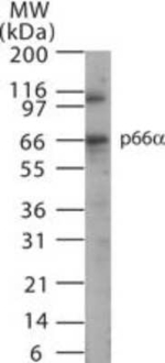 GATAD2A Antibody in Western Blot (WB)