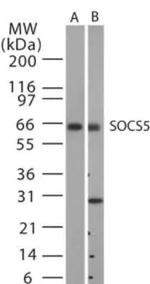 SOCS5 Polyclonal Antibody