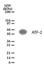 ATF2 Polyclonal Antibody